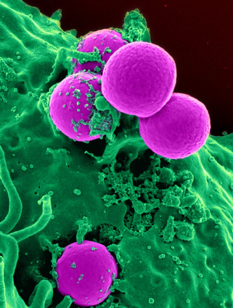 Antimikroba dari Ekstrak Kurkumin